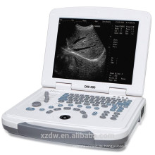 DW-500 Laptop Ultraschallgerät &amp; Ultraschallgerät mit Akku